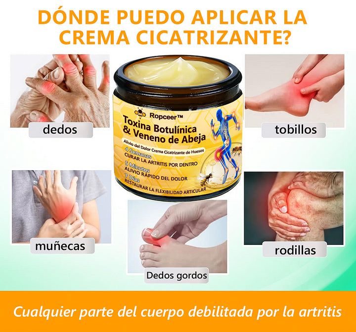 AGUIJON DE ABEJAS PARA ALIVIO Y TRATAMIENTO DEL DOLOR ROPCEER™ - CICATRIZANTE DE HUESOS